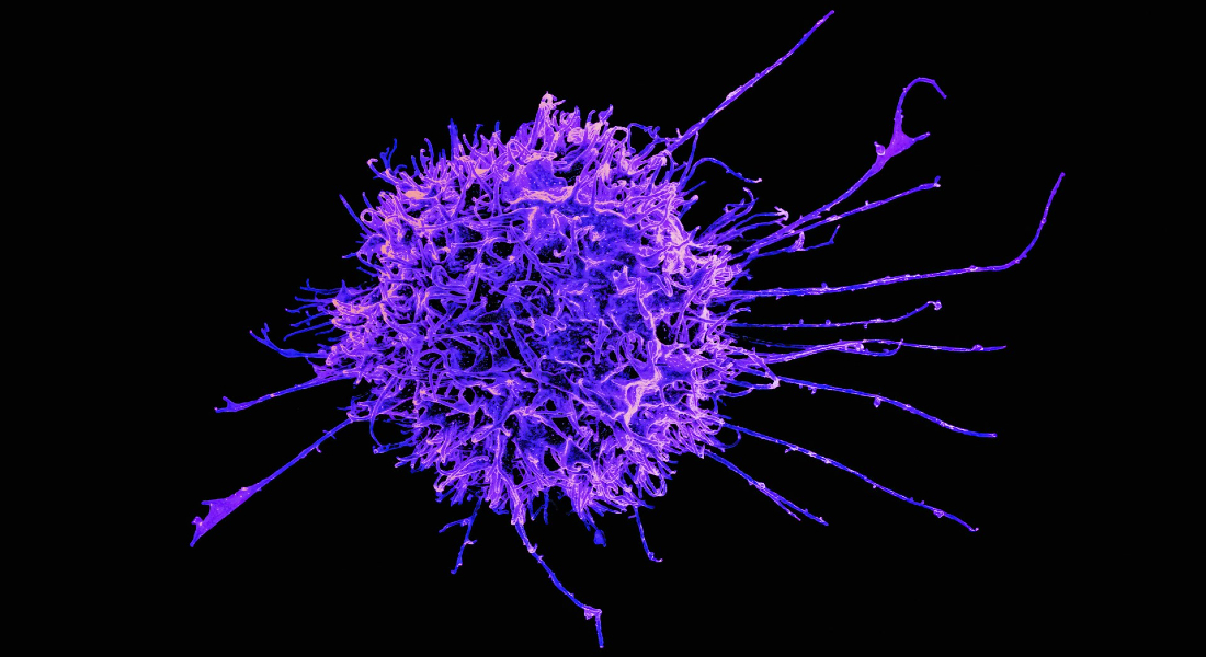 Natural killer cell